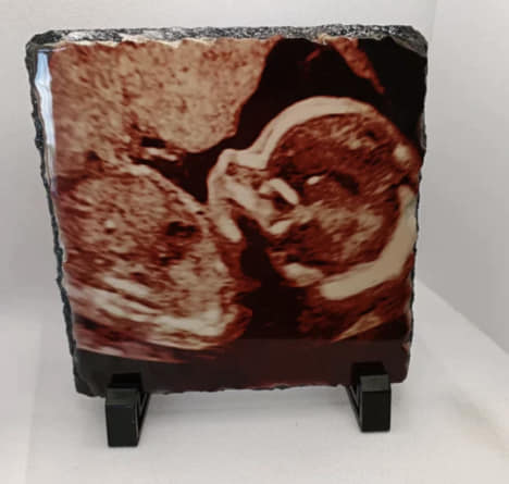 Personalised Baby Scan Slate | Ultrasound Photo Gift UK